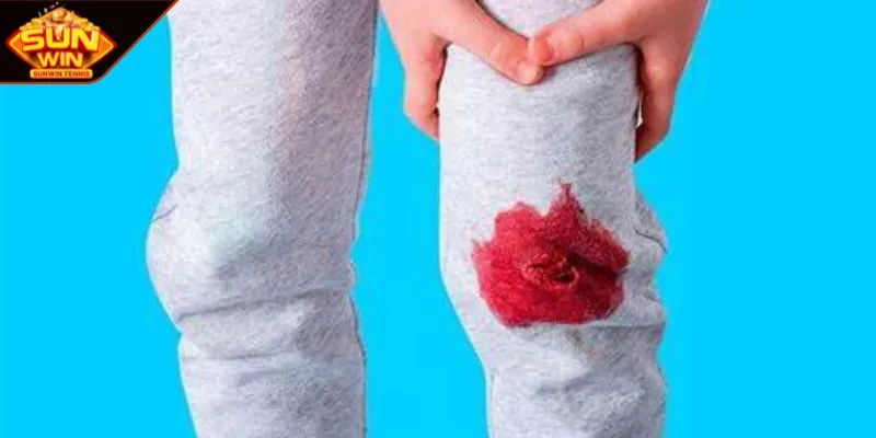 Chiêm bao chảy máu chân khó khăn khi tiến về phía trước
